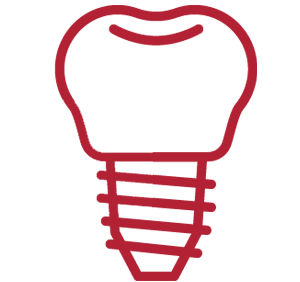 Single-Tooth Implants